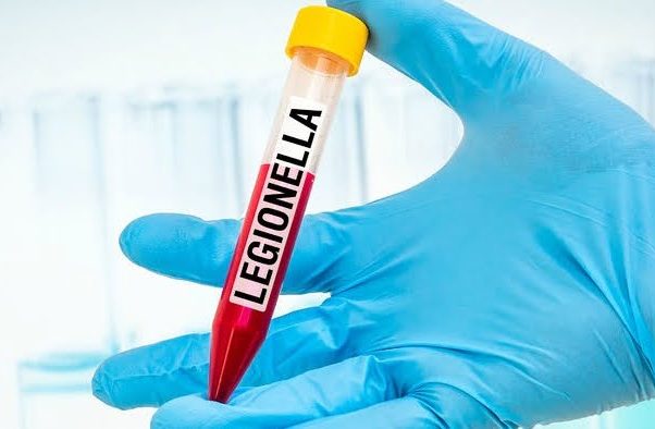 UKAS Accredited and On-Site Legionella Testing