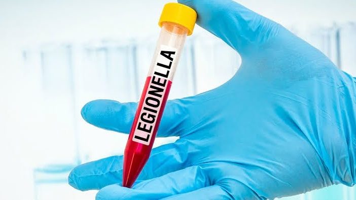 UKAS Accredited and On-Site Legionella Testing UKAS Accredited and On-Site Legionella Testing